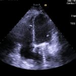 Figura 1