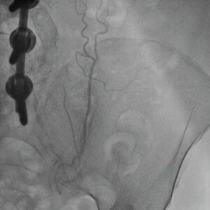 Figura 4