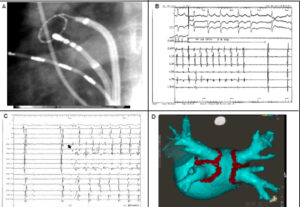 Figure 12
