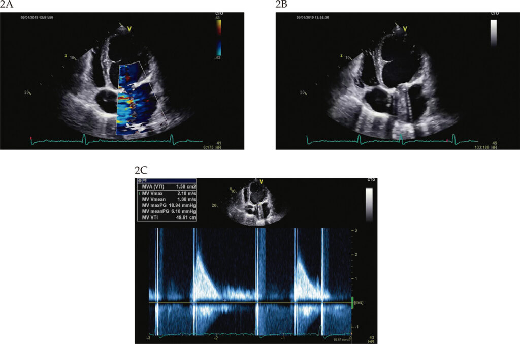 Figure 2