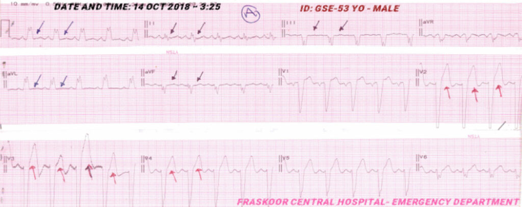 Figure 1A