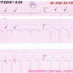 Figure 1A