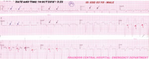 Figure 1A