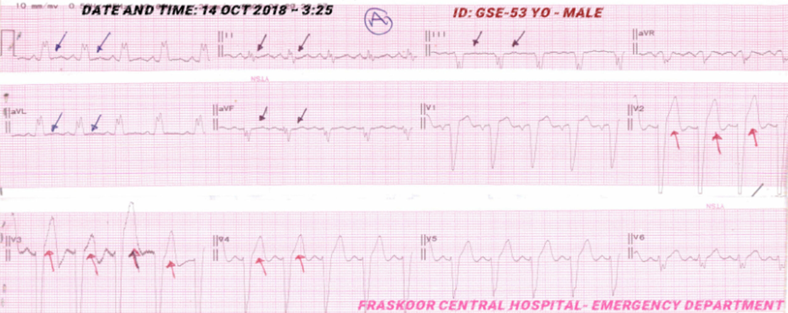 Figure 1A