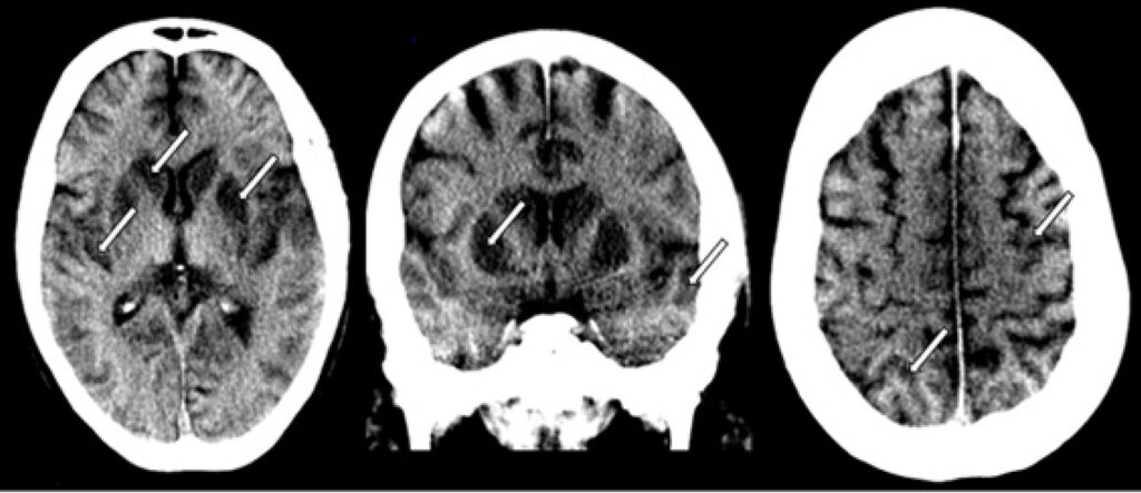 Figure 9