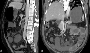 Figure 16