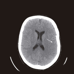 Figure 9