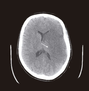 Figure 10