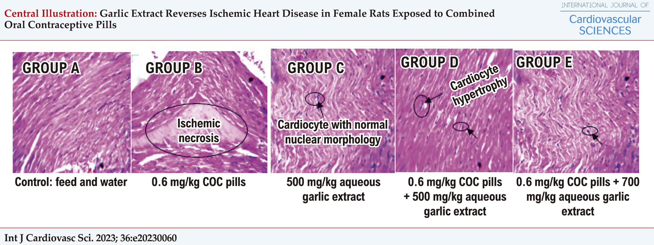 Garlic Extract Reverses Ischemic Heart Disease in Female Rats Exposed to Combined Oral Contraceptive Pills