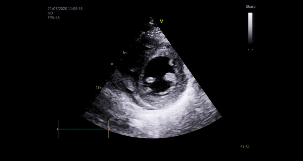 Video 3