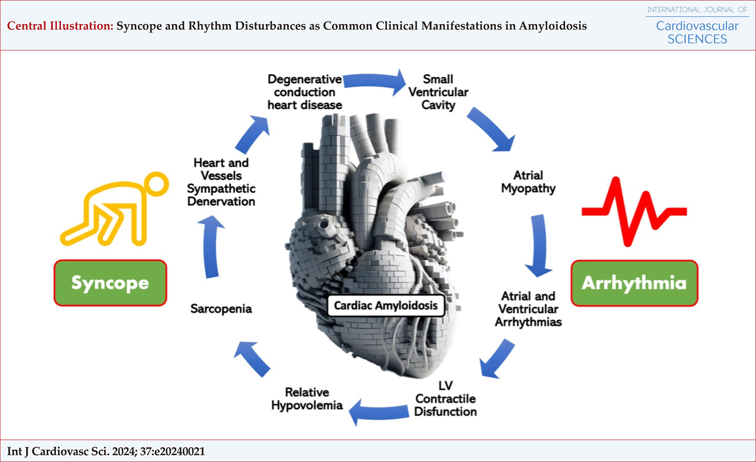 Syncope and Rhythm Disturbances as Common Clinical Manifestations in Amyloidosis