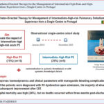 CDT: catheter-directed therapy; PE: pulmonary embolism; RV: right ventricle/cular.