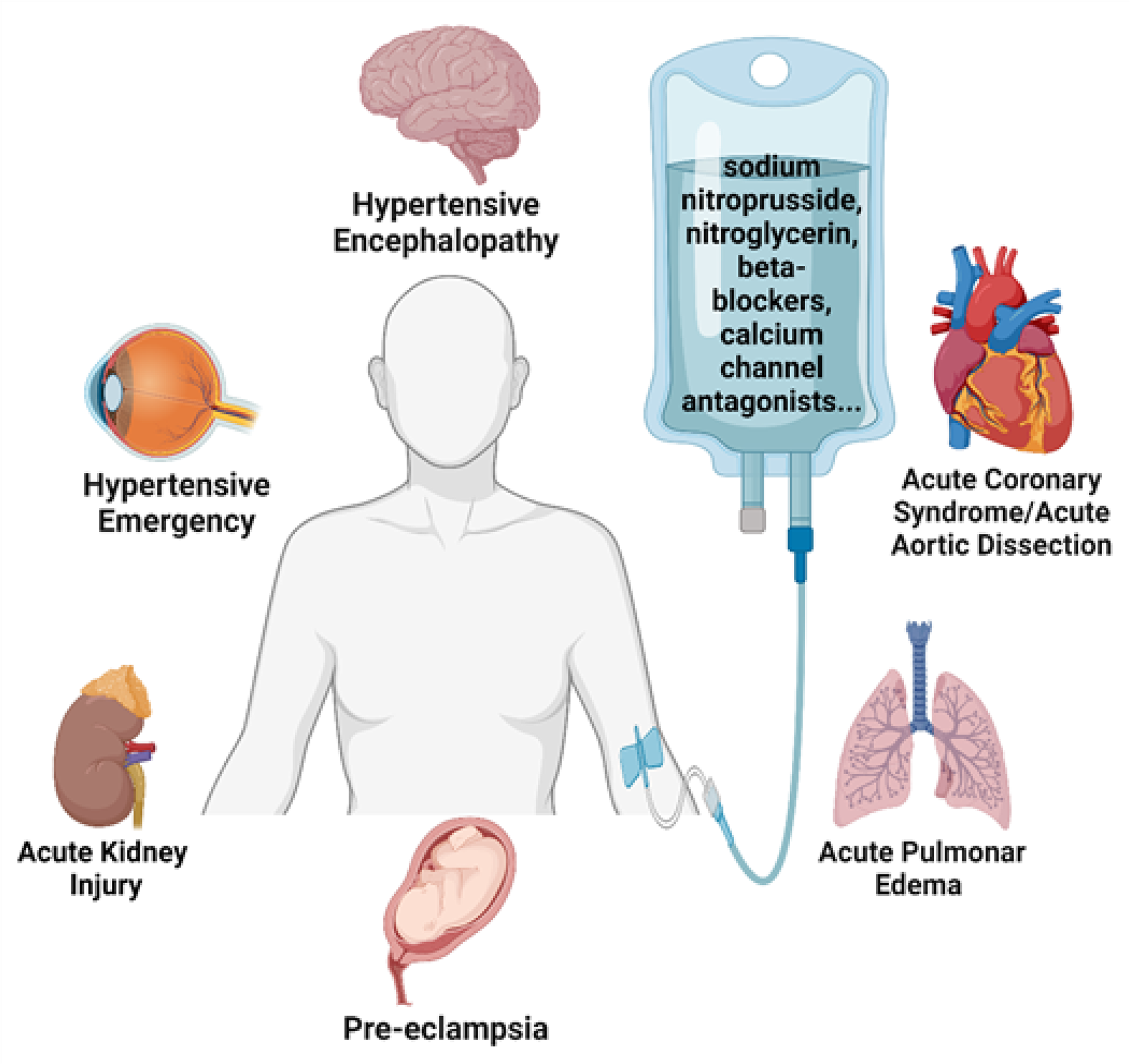 Strategic Use of Intravenous Medications to Protect Target Organs in Hypertensive Emergencies