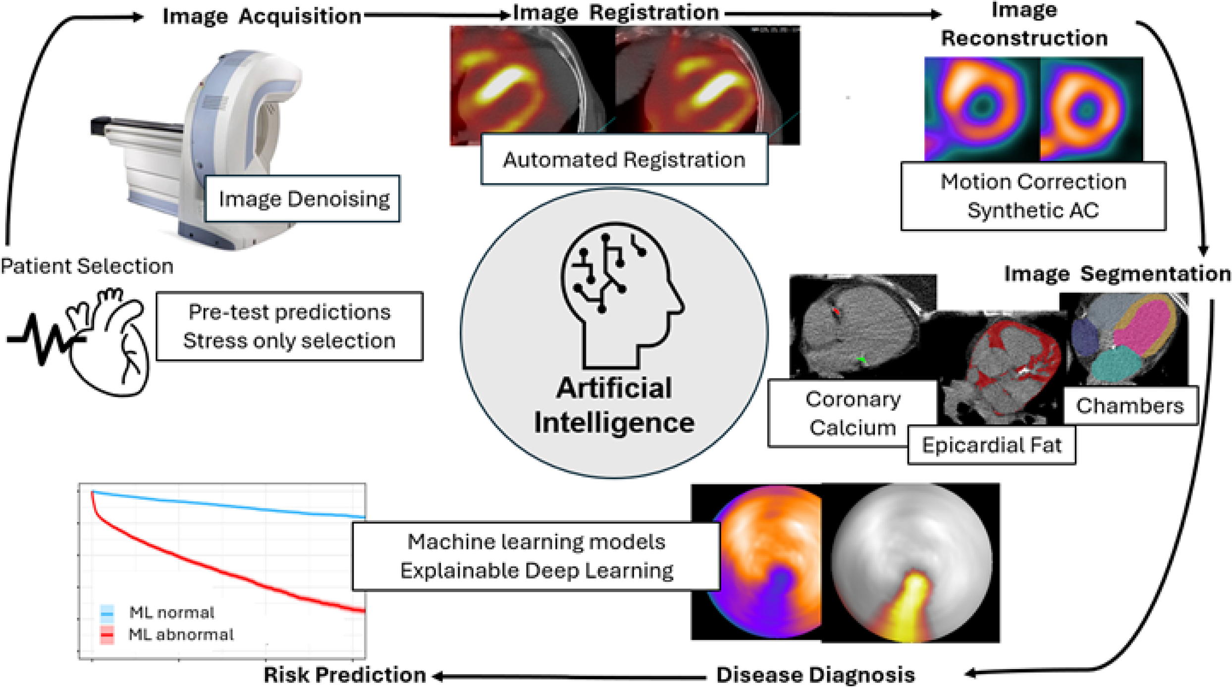 Artificial intelligence for nuclear cardiology: Perspectives and challenges