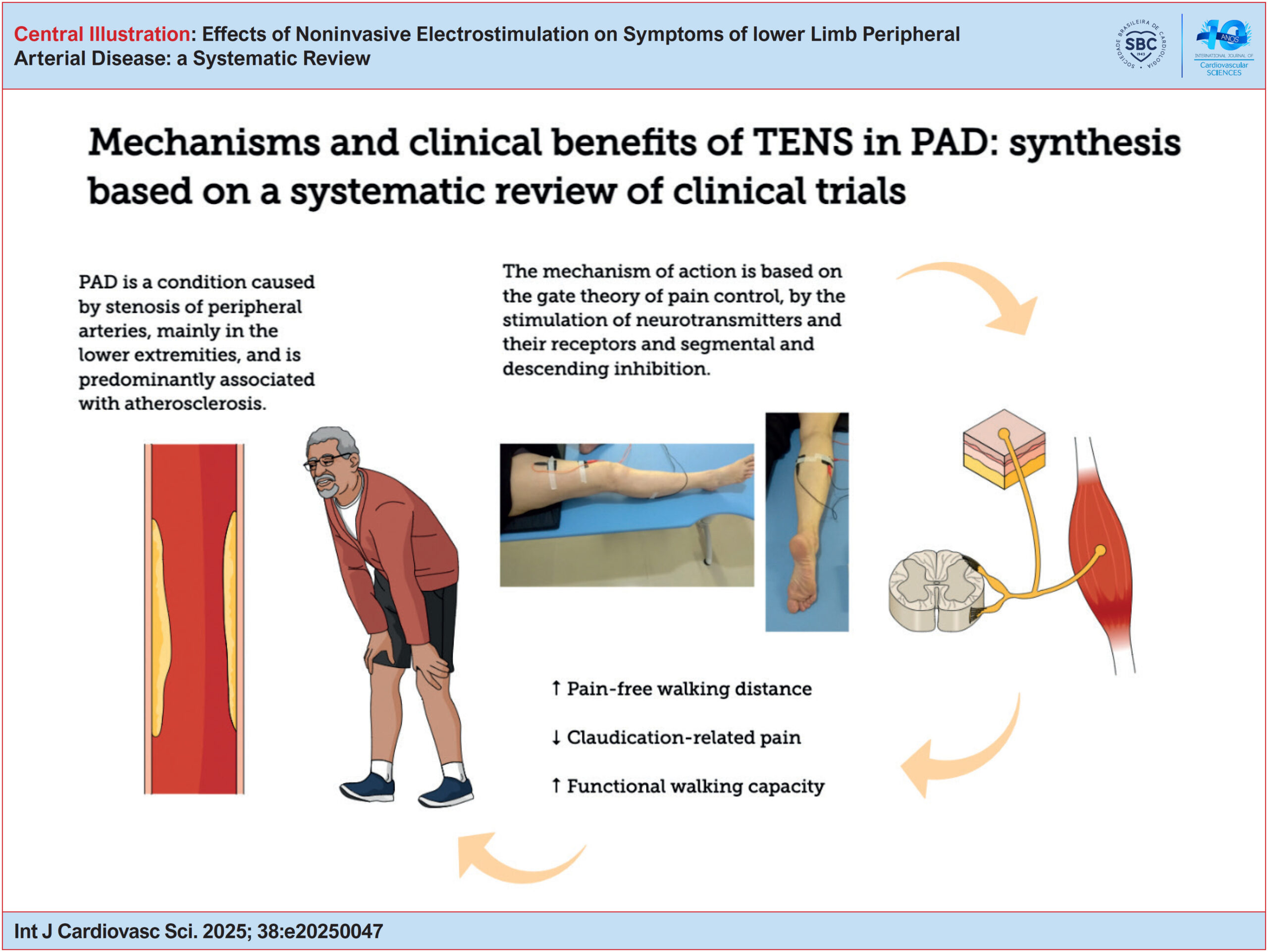 Effects of Noninvasive Electrostimulation on Symptoms of lower Limb Peripheral Arterial Disease: a Systematic Review