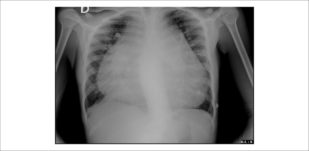 Figura 2