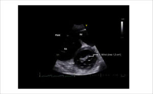 Video 1
