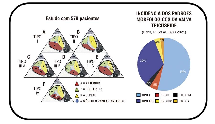 Figura 1
