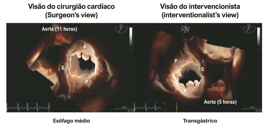 Figura 2
