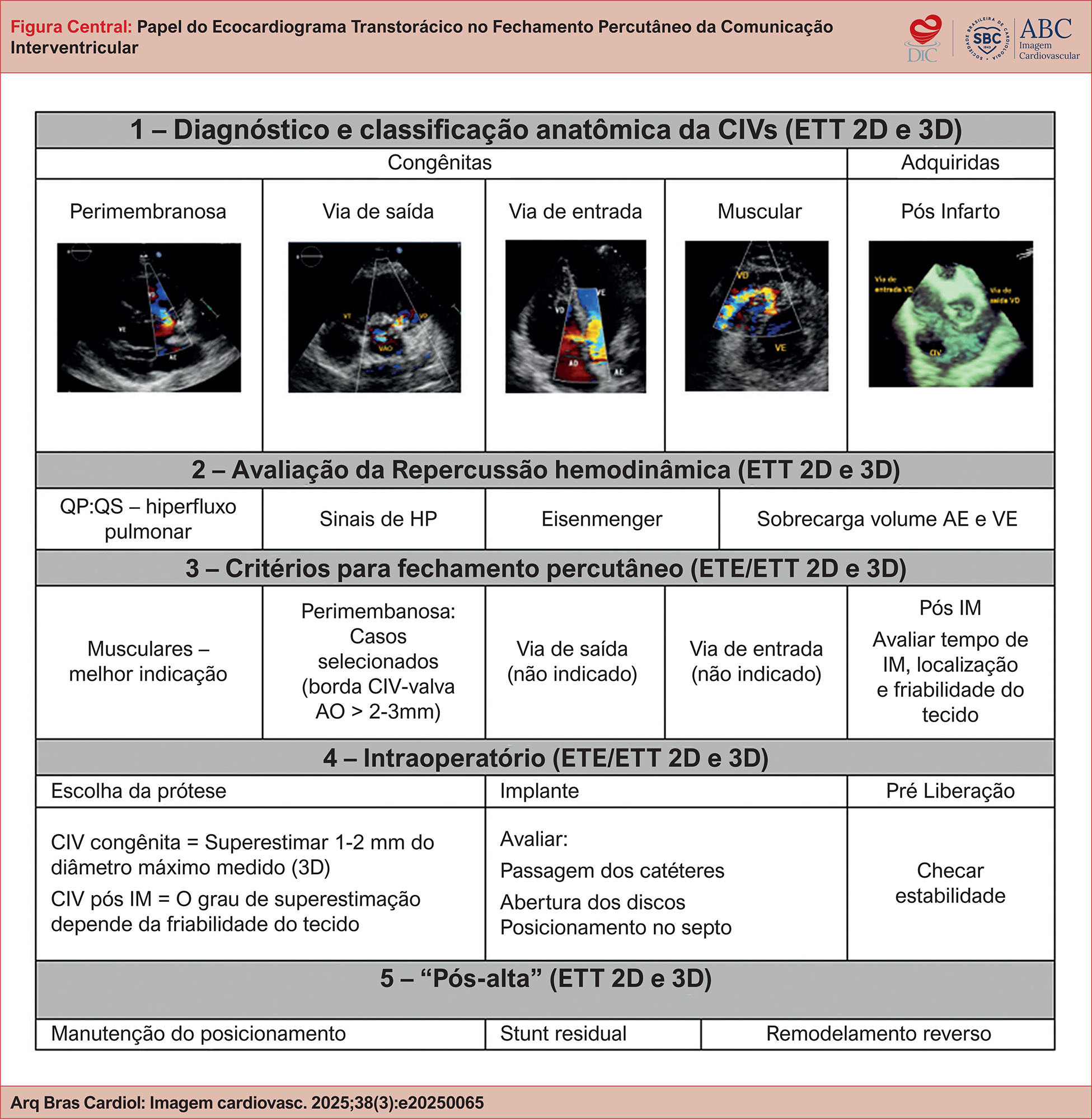 Papel do Ecocardiograma Transtorácico no Fechamento Percutâneo da Comunicação Interventricular