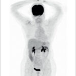 Figura 2