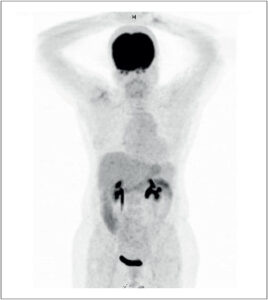 Figura 2