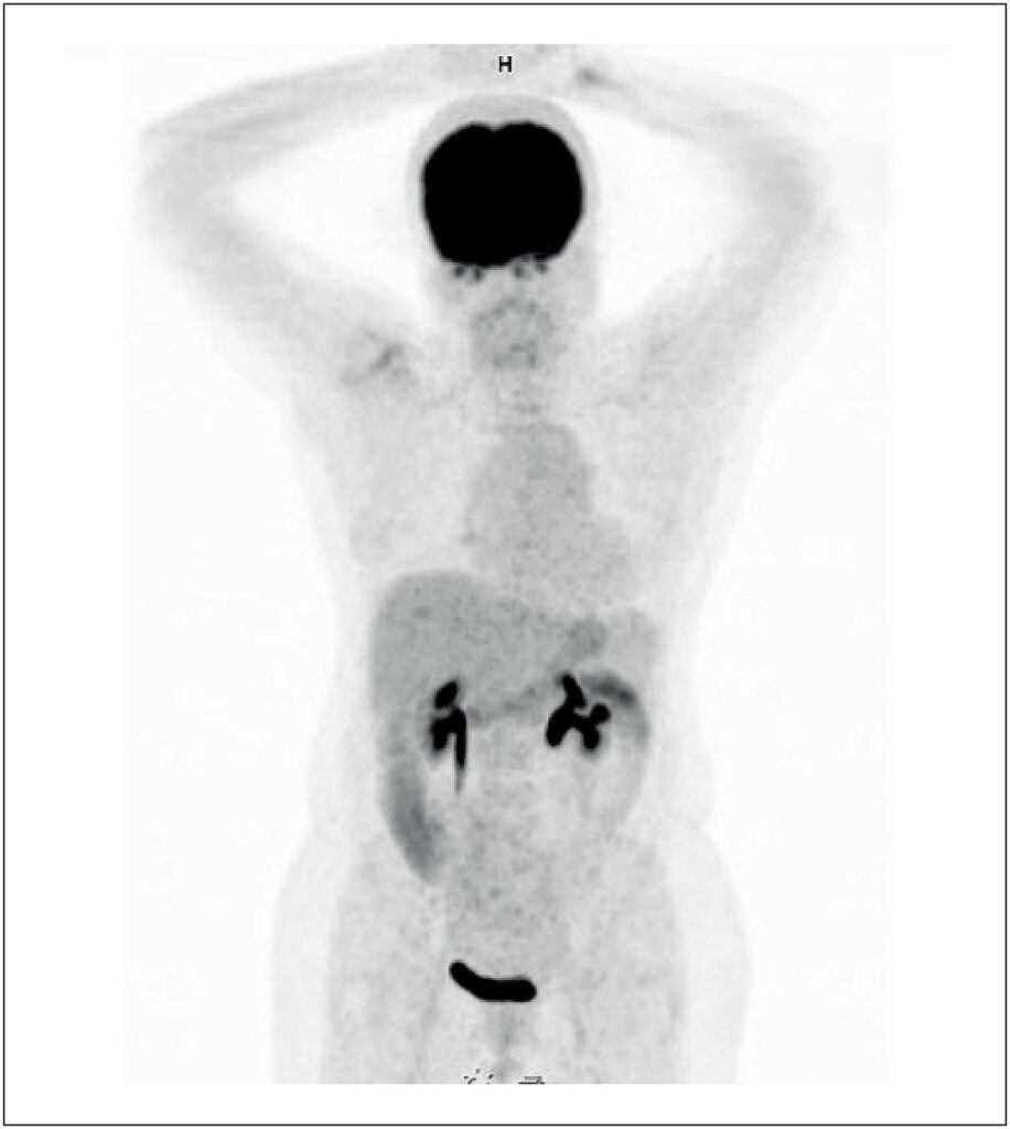Figura 2