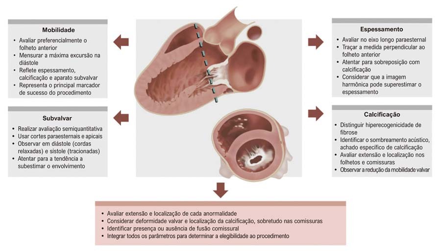 Como eu Faço Escore de Wilkins-Block na Estenose Mitral Reumática