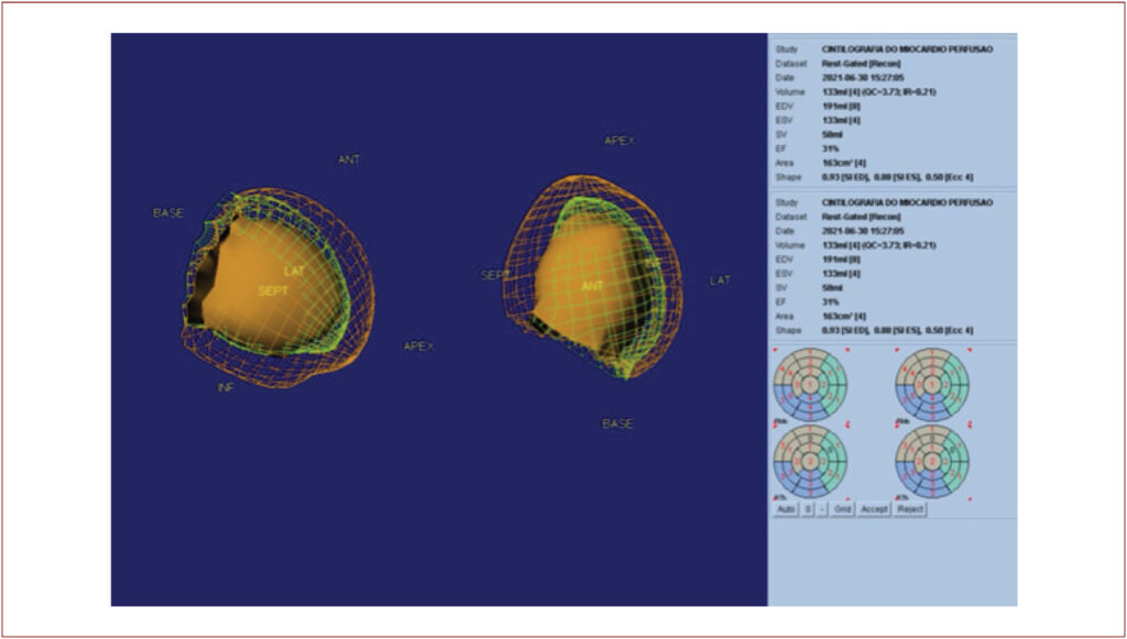 Figure 6