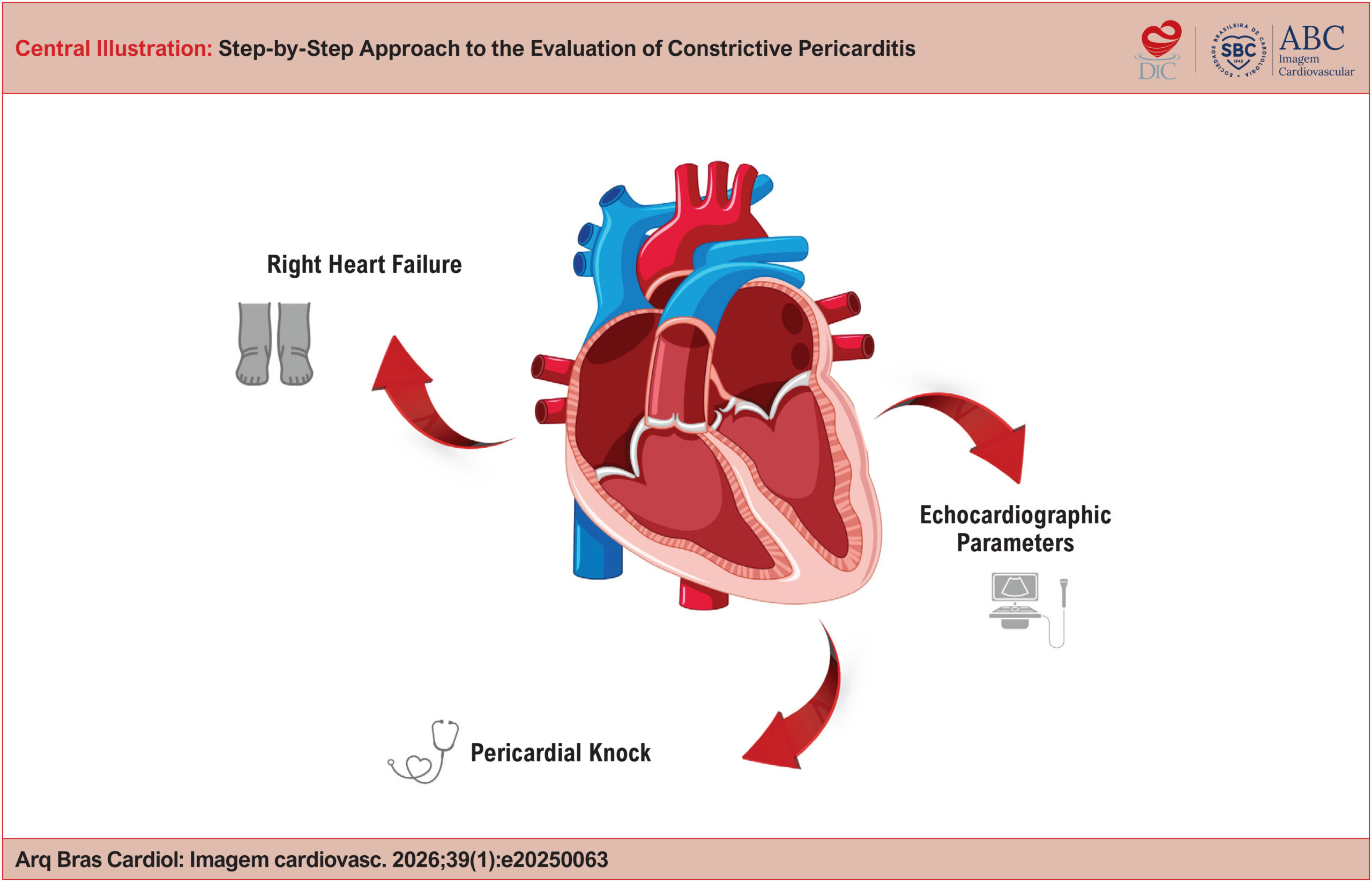 Step-by-Step Approach to the Evaluation of Constrictive Pericarditis