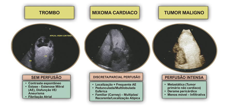 Figura 1