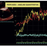 Figura 3