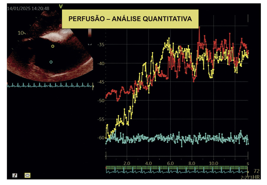 Figura 3