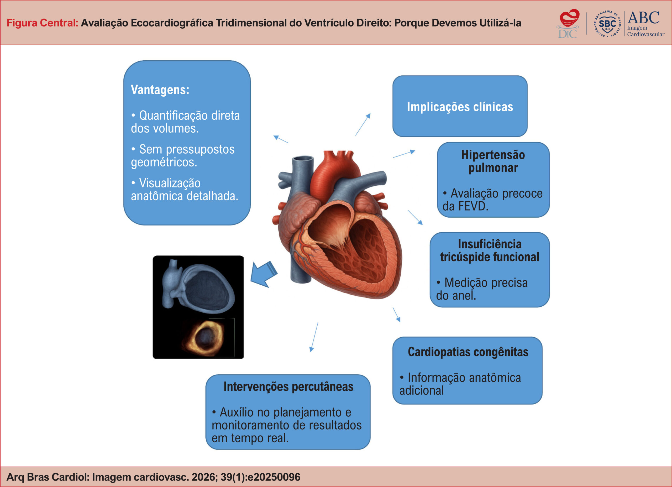 Avaliação Ecocardiográfica Tridimensional do Ventrículo Direito: Porque Devemos Utilizá-la