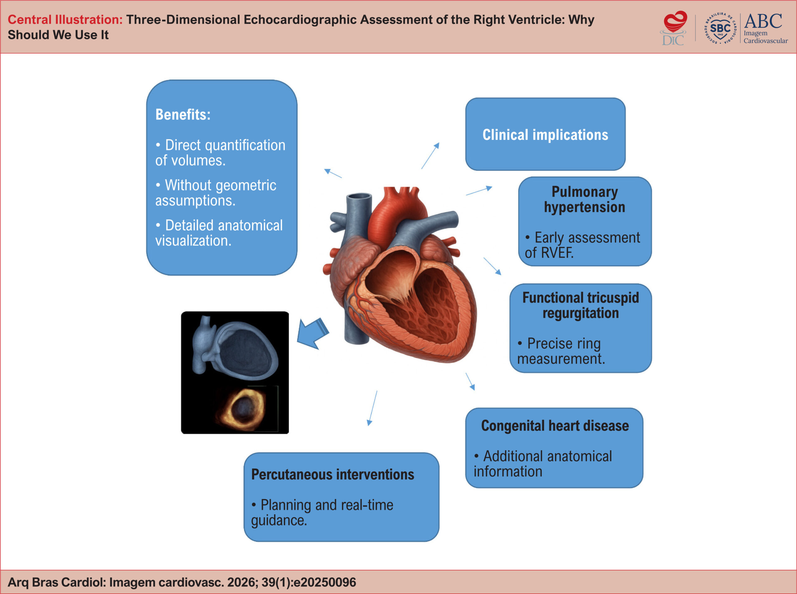 Three-Dimensional Echocardiographic Assessment of the Right Ventricle: Why Should We Use It