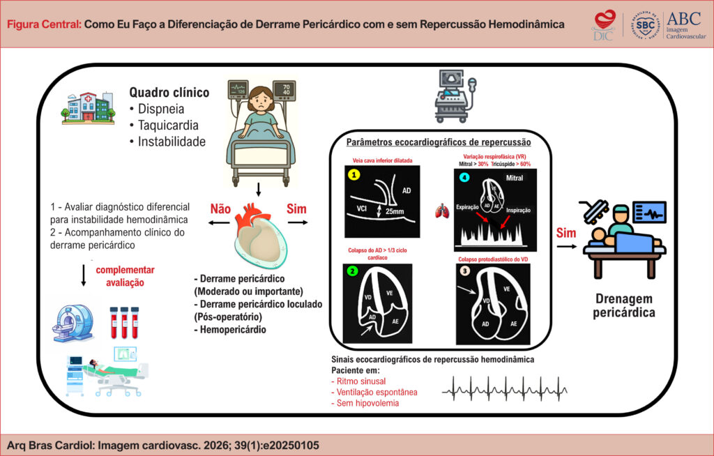 AD: átrio direito; AE: átrio esquerdo; VCI: veia cava inferior; VD: ventrículo direito; VE: ventrículo esquerdo.