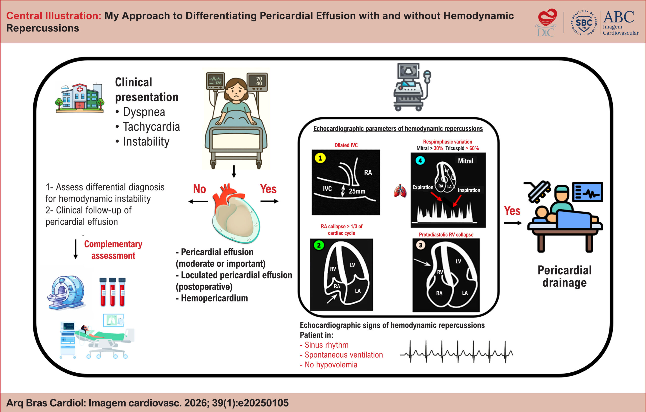 My Approach to Differentiating Pericardial Effusion with and without Hemodynamic Repercussions