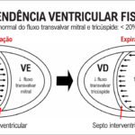 Figura 2
