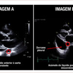 Figura 3