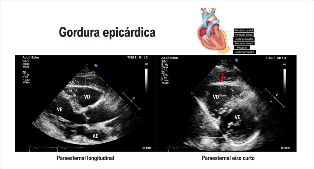 Figura 4
