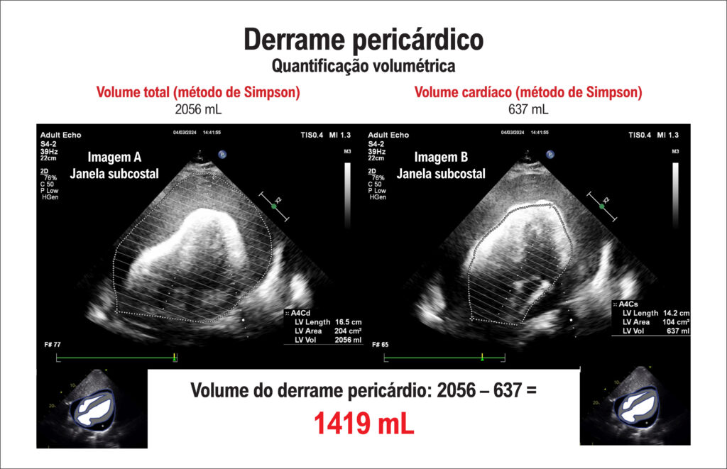 Figura 6
