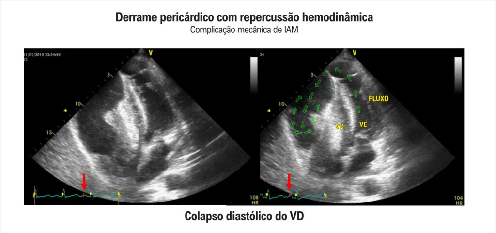 Figura 9