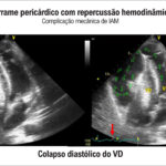 Figura 9