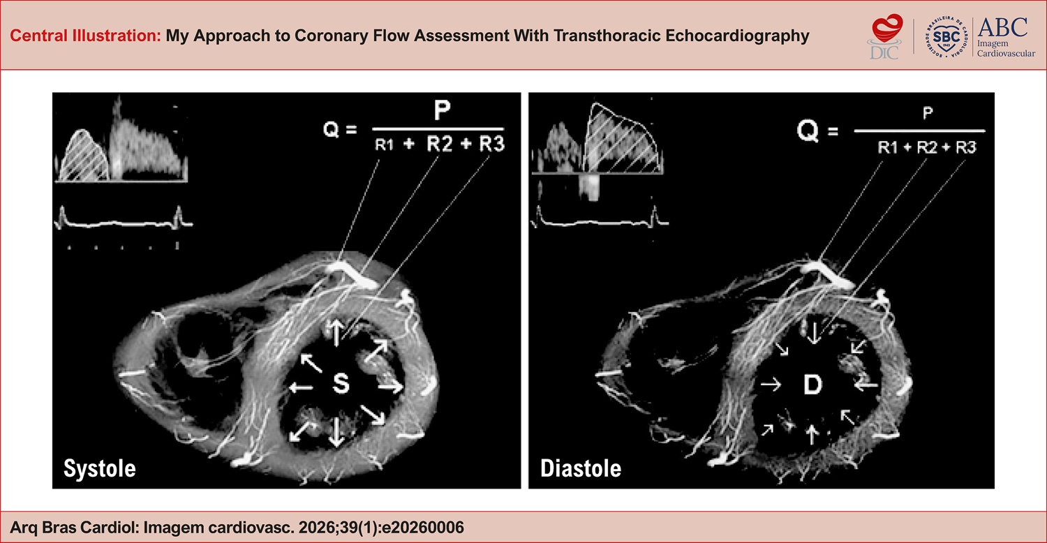 My Approach to Coronary Flow Assessment With Transthoracic Echocardiography