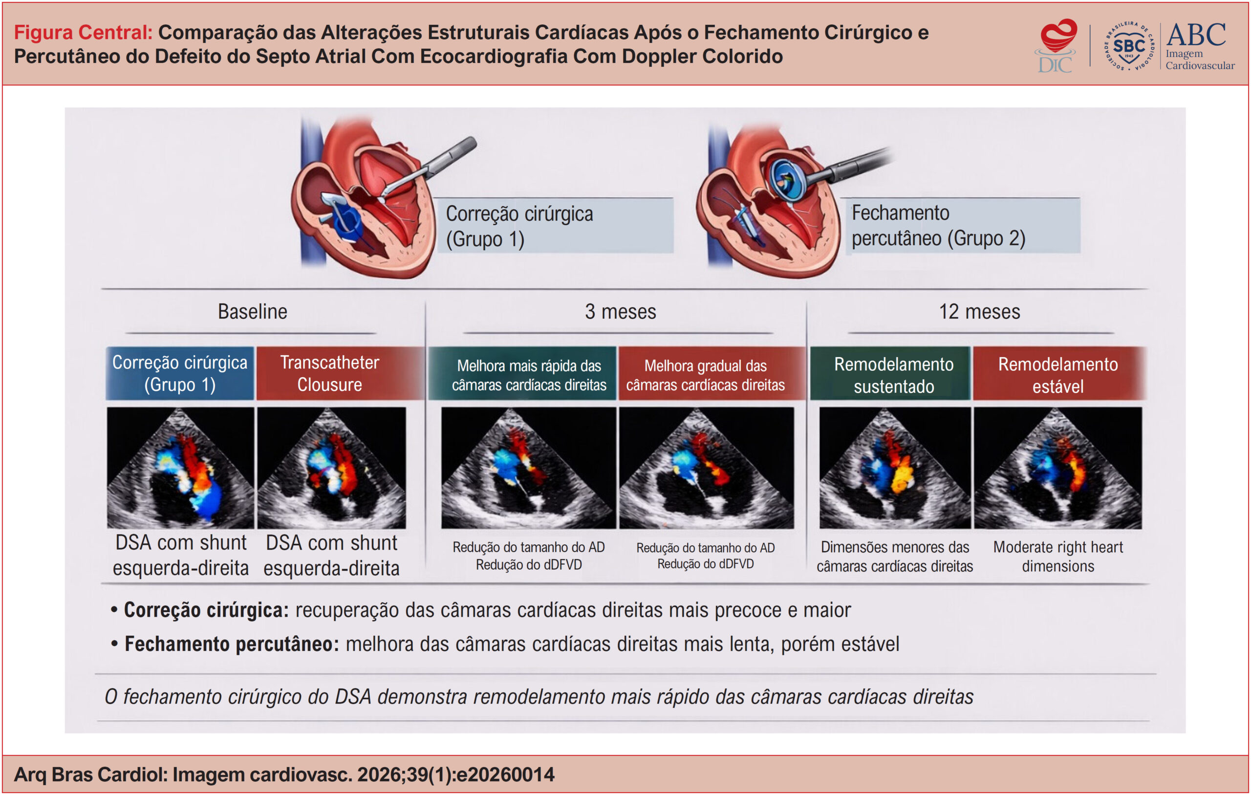 Comparação das Alterações Estruturais Cardíacas Após o Fechamento Cirúrgico e Percutâneo do Defeito do Septo Atrial Com Ecocardiografia Com Doppler Colorido