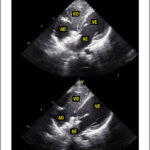 Figura 2