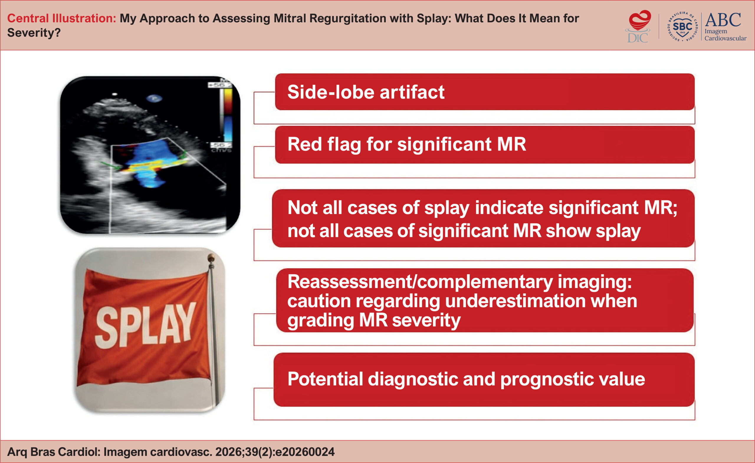 My Approach to Assessing Mitral Regurgitation with Splay: What Does It Mean for Severity?