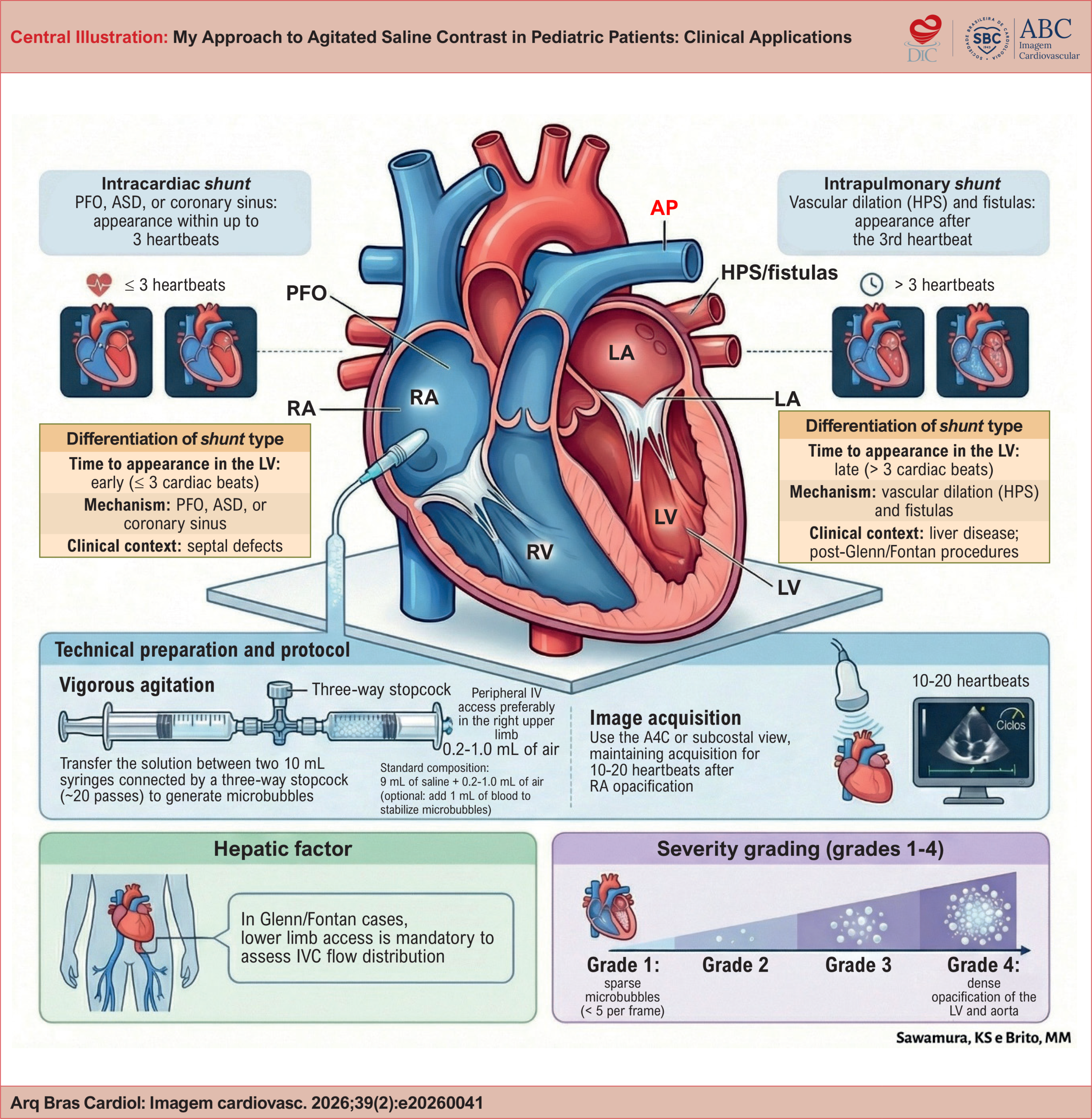 My Approach to Agitated Saline Contrast Echocardiography in Pediatric Patients