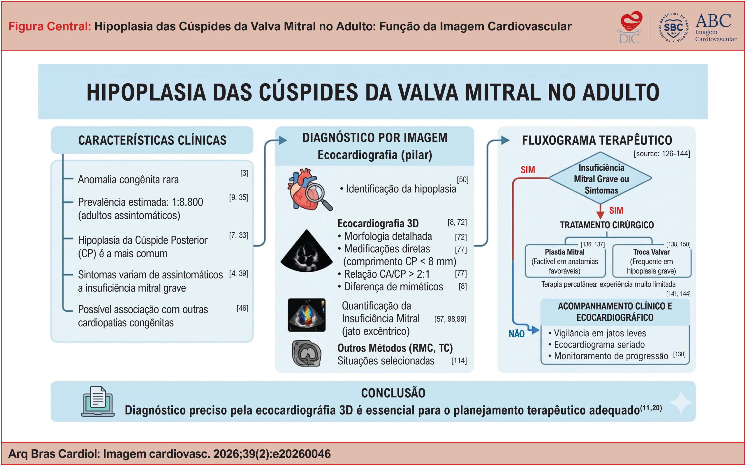Hipoplasia das Cúspides da Valva Mitral no Adulto: Função da Imagem Cardiovascular