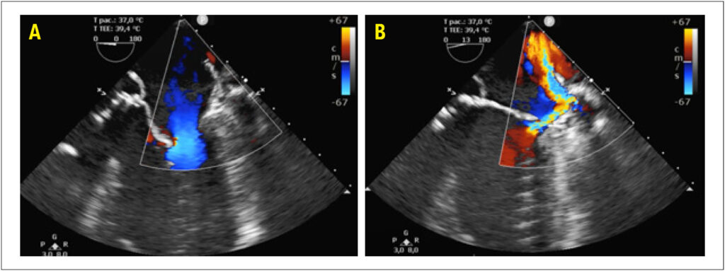 Figure 5